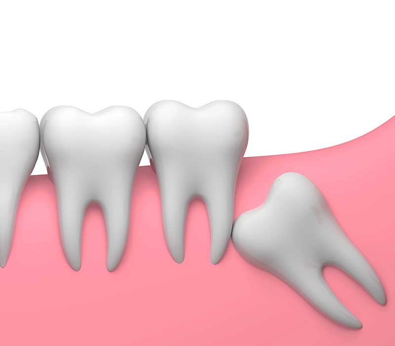 Immagine dente del giudizio