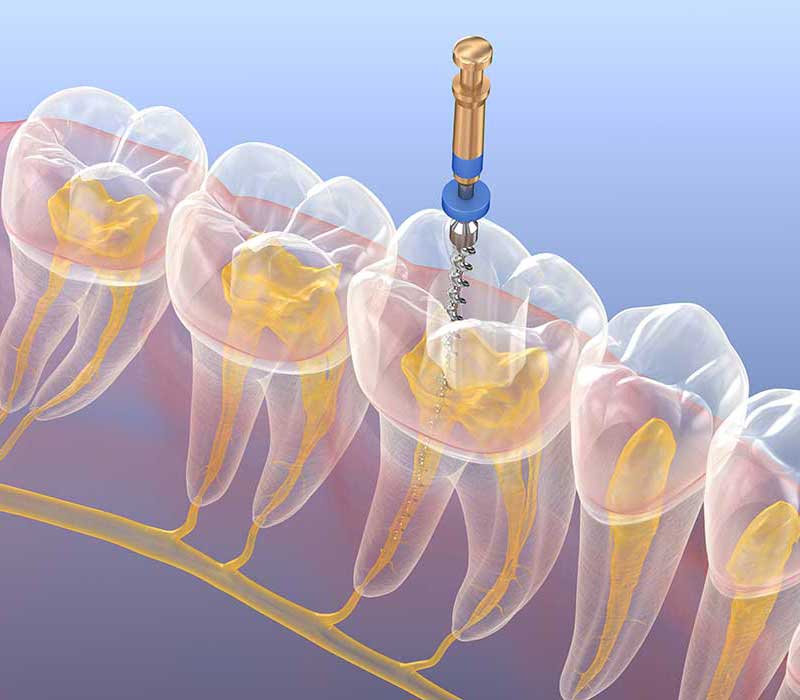 Endodonzia