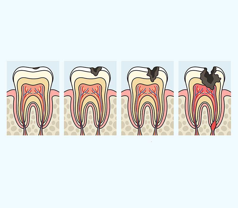 Immagine denti