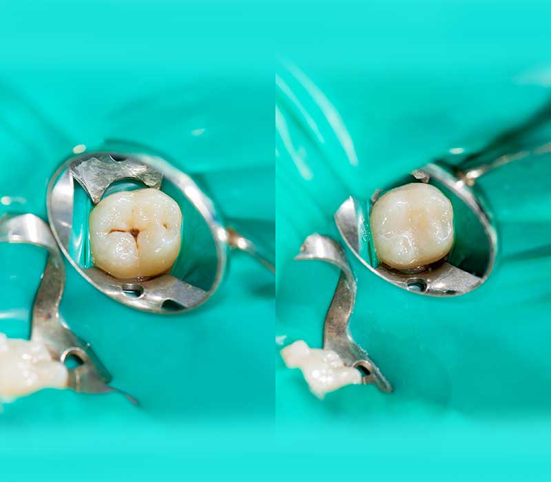 Trattamento dentistico