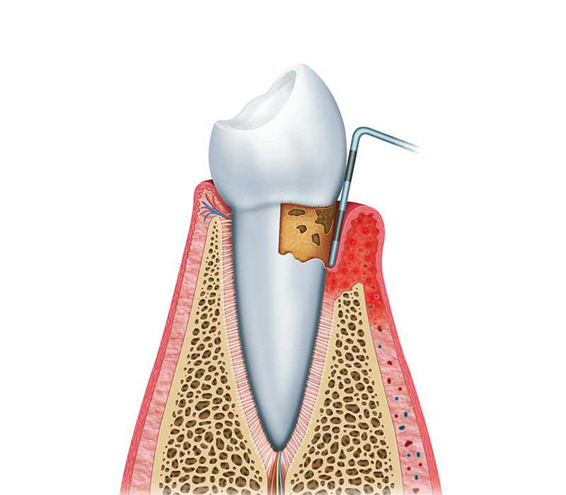 Immagine parodontologia