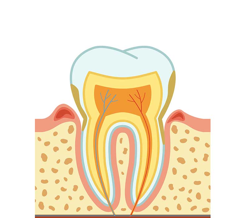 Immagine trattamento dentale